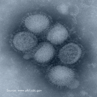 甲型流感病毒